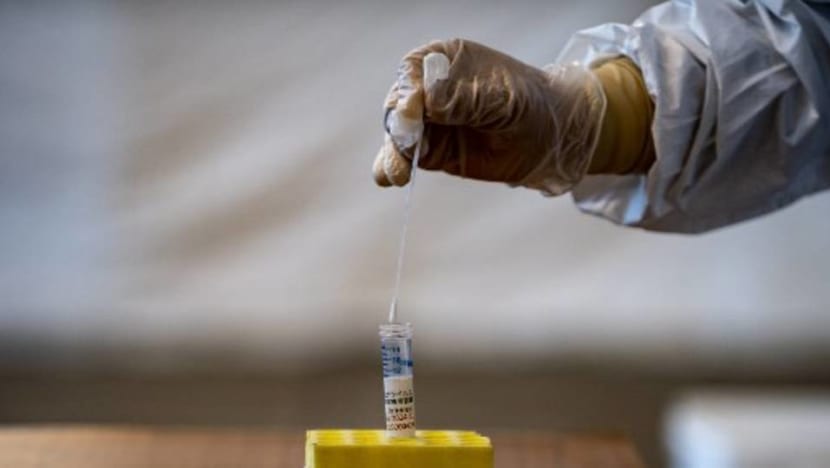 Cold symptoms that people normally 'shrug off' make mild cases of COVID-19 hard to detect: Experts Cold symptoms that people normally 'shrug off' make mild cases of COVID-19 hard to detect: Experts