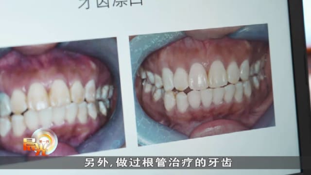 晨光|养生时膳：根管治疗助保牙 芋头可强化牙齿