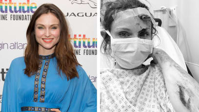 Singer Sophie Ellis-Bextor Shares "Gory" Picture From Hospital Following Bike Accident