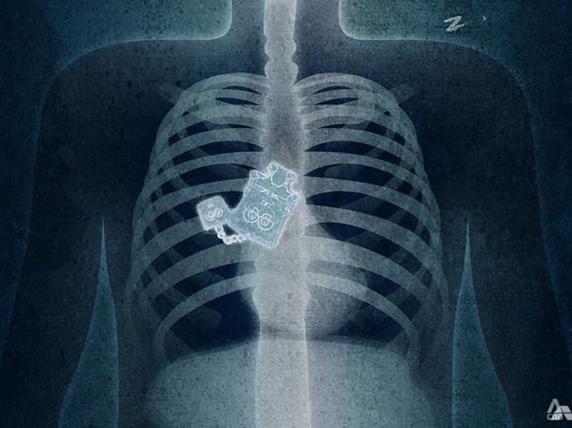 What to do when you've swallowed something you shouldn't have What to do when you've swallowed something you shouldn't have
