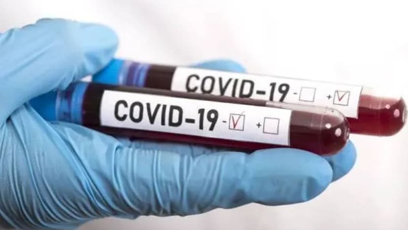Korea Selatan lulus ujian klinikal kit COVID-19