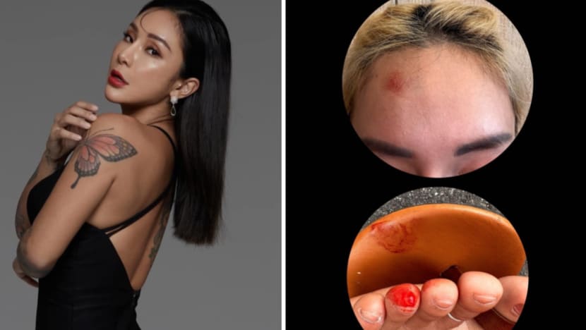 Taiwanese Rapper Nana Liang Left Bleeding After Accident In Taxi; First Thing Driver Did Was Ask Her To Pay The Fare