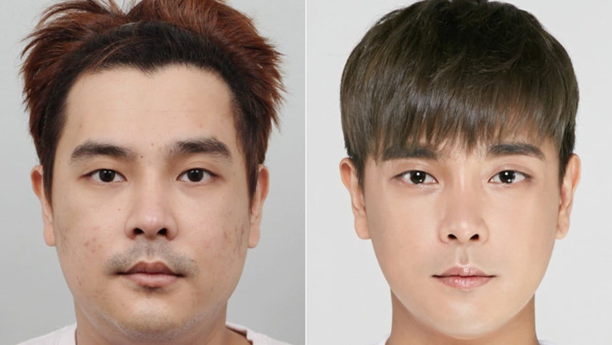Chinese outlet eye operation