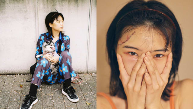 录影发生意外　日本女偶像头部缝30针