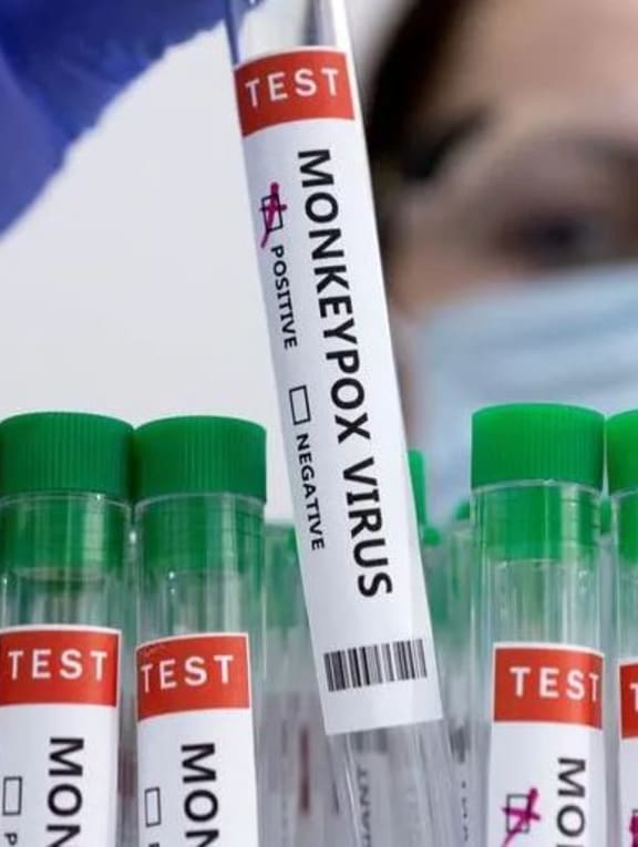 Singapore reports 13th case of monkeypox infection since June Singapore reports 13th case of monkeypox infection since June