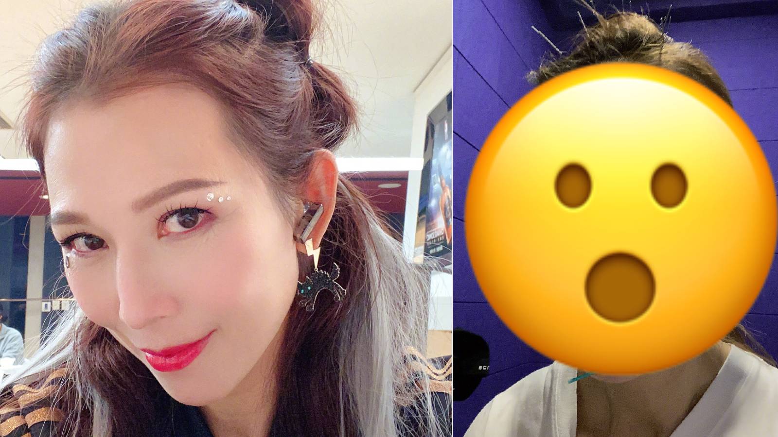 Ada Choi’s Facial Acupuncture Session Is Weirdly Cool… Yet Creepy Ada Choi’s Facial Acupuncture Session Is Weirdly Cool… Yet Creepy