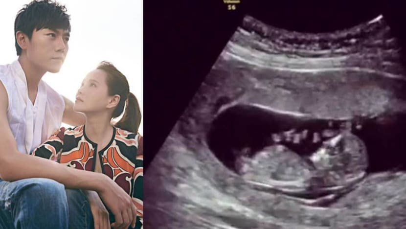 Annie Yi’s husband confirms they’re expecting Annie Yi’s husband confirms they’re expecting