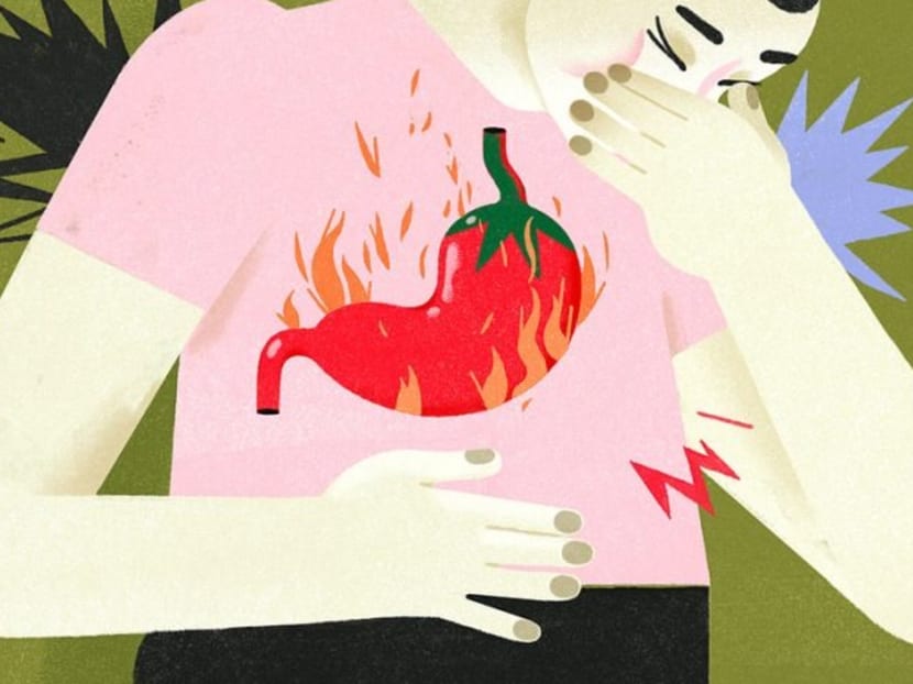 Do you have heartburn and acid reflux? Here are diet tips to help Do you have heartburn and acid reflux? Here are diet tips to help