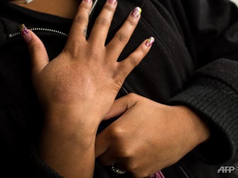 Commentary: Low self-esteem, depression and frequent flare-ups plague growing numbers of eczema sufferers Commentary: Low self-esteem, depression and frequent flare-ups plague growing numbers of eczema sufferers