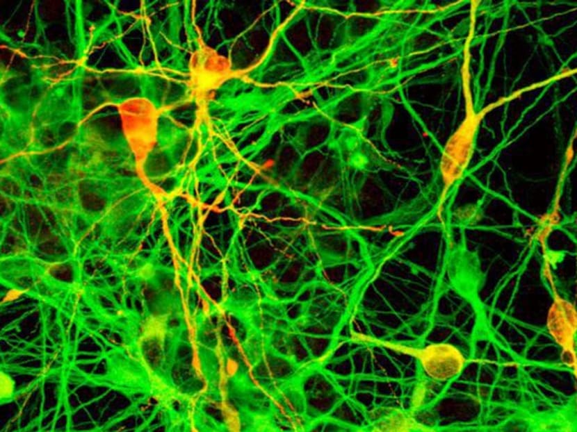 Dopaminergic neurons (stem cells). Photo: Reuters