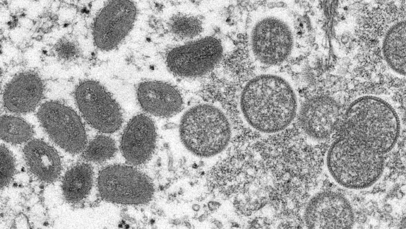 Australia reports first monkeypox case in traveller from Britain Australia reports first monkeypox case in traveller from Britain