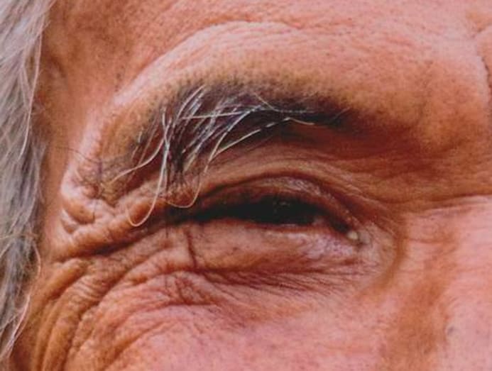 Where does hair grow the fastest or slowest – on your head or body? - CNA Lifestyle Where does hair grow the fastest or slowest – on your head or body? - CNA Lifestyle