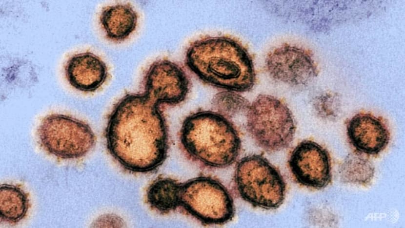 25 COVID-19 cases with B117 variant found in Singapore: MOH 25 COVID-19 cases with B117 variant found in Singapore: MOH