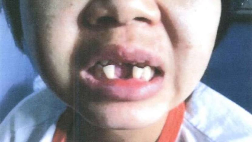 Jail for woman who hammered out maid’s teeth in 'worst' recent case of abuse