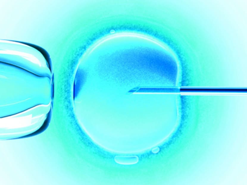 In some male fertility cases, Intracytoplasmic Sperm Injection in which a single sperm is injected directly into an egg to achieve fertilisation, is used. Photo: Thinkstock