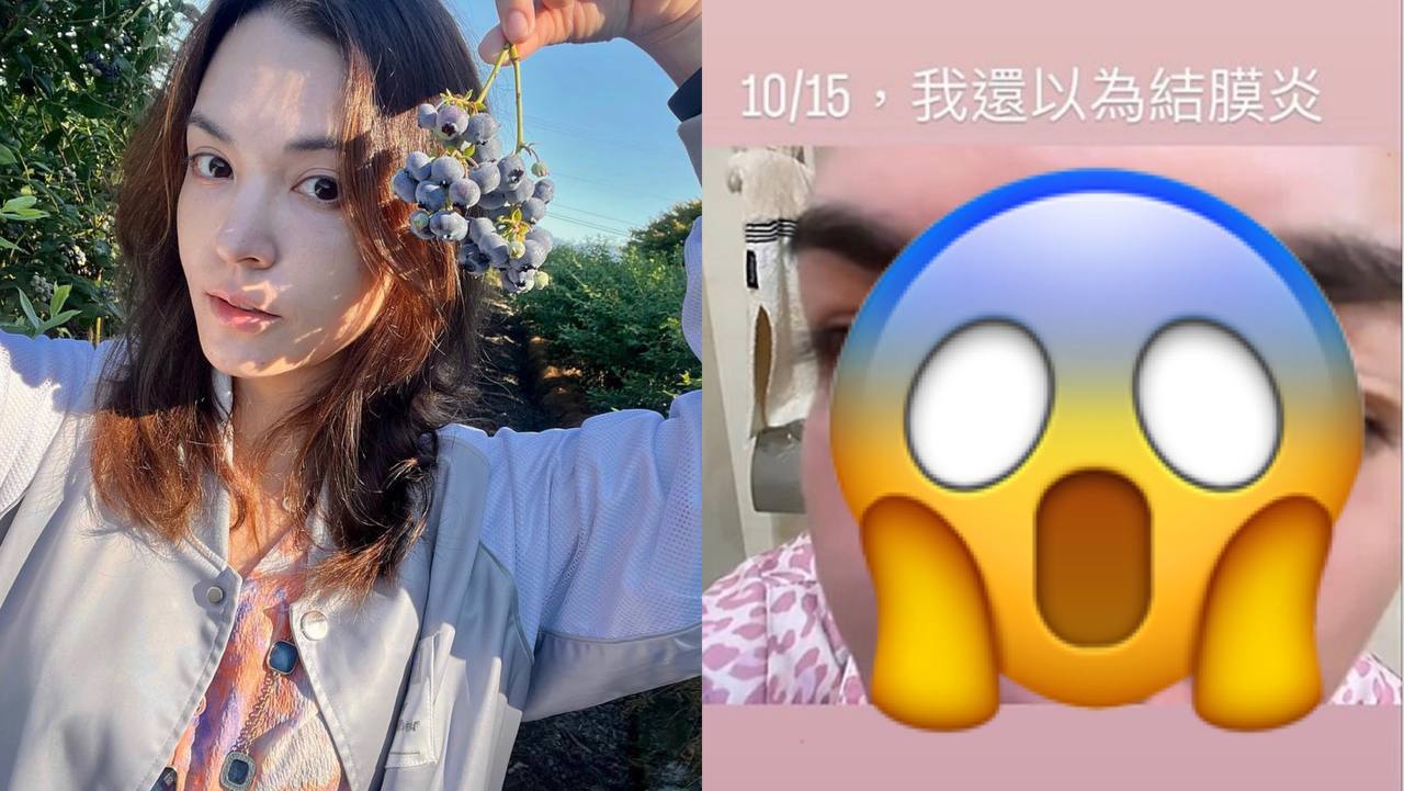 Taiwanese Actress Sandrine Pinna Had An Allergic Reaction So Bad, It Made Her Face Resemble "A Pig's Head" Taiwanese Actress Sandrine Pinna Had An Allergic Reaction So Bad, It Made Her Face Resemble "A Pig's Head"