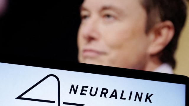 神经技术公司获美国食品局批准 植入式脑晶片展开人体试验