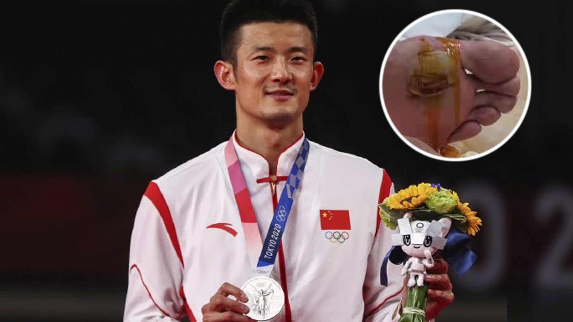 Chinese Olympic Shuttler Chen Long Was Called “Useless” For Not Winning Badminton Gold; Coach Reveals How Badly Blistered His Feet Were During Match Chinese Olympic Shuttler Chen Long Was Called “Useless” For Not Winning Badminton Gold; Coach Reveals How Badly Blistered His Feet Were During Match