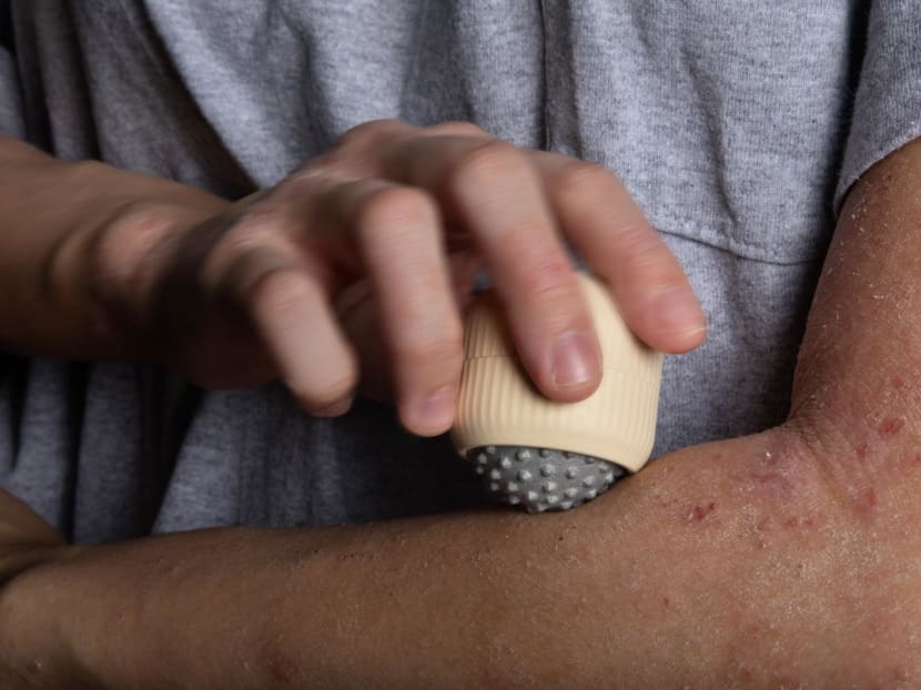 The rollerball itch reliever, runner-up in the 2022 Singapore National James Dyson Award The rollerball itch reliever, runner-up in the 2022 Singapore National James Dyson Award