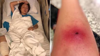 How Did A Small Bug Bite Cause Quan Yifeng To Get Hospitalised And Undergo Two Surgeries?