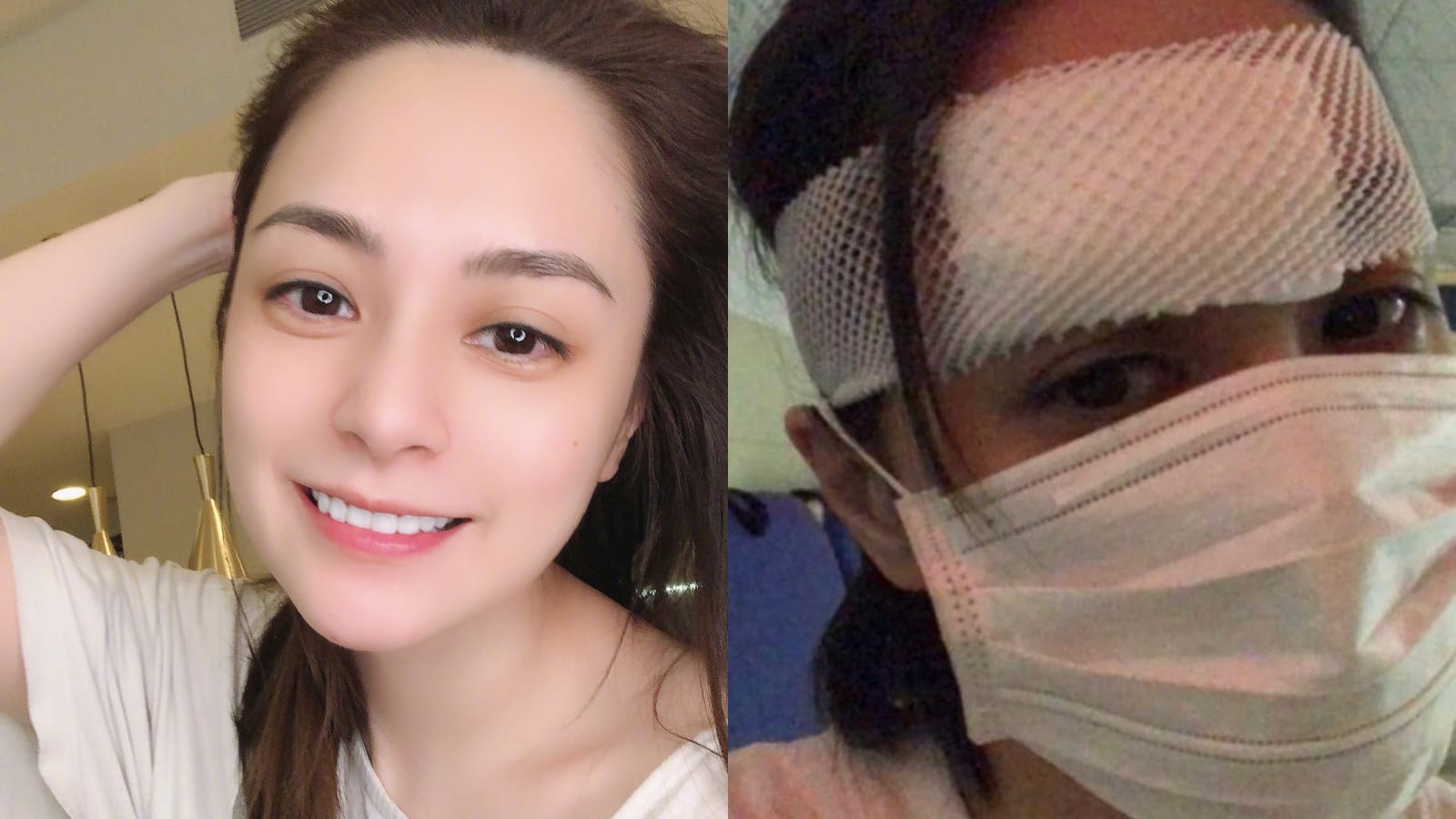 More Details About Gillian Chung’s Hotel Room Accident, Which Left Her With A 6cm Wound On Her Head More Details About Gillian Chung’s Hotel Room Accident, Which Left Her With A 6cm Wound On Her Head