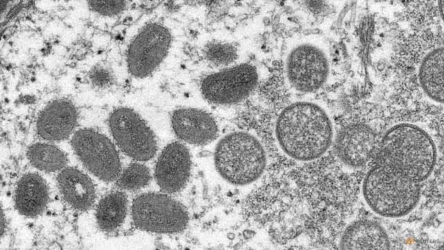 法国出现首起女性感染猴痘病例