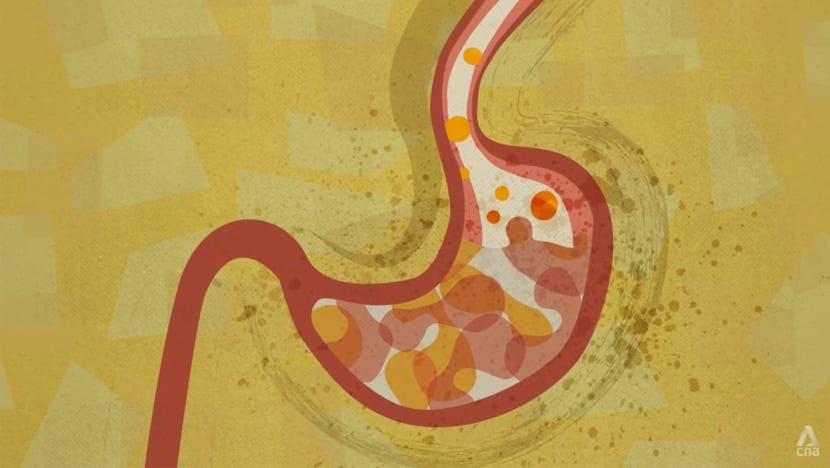 your ageing gut hero