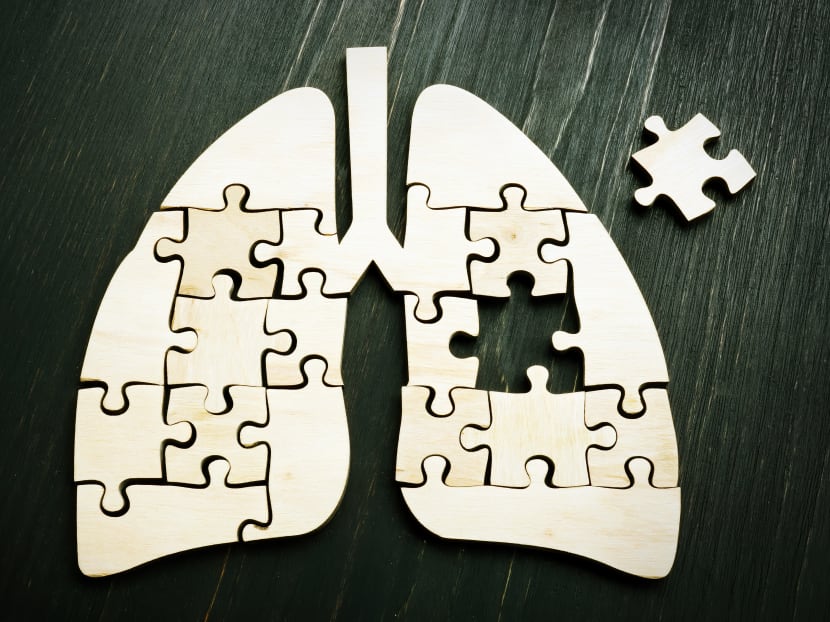 It started with a dry cough and fatigue, then non-smoker finds out she has stage 4 lung cancer It started with a dry cough and fatigue, then non-smoker finds out she has stage 4 lung cancer