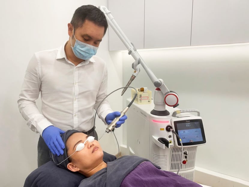 mastermind hjerne Dokument Fotona laser treatments help customers put their best face forward - CNA  Lifestyle