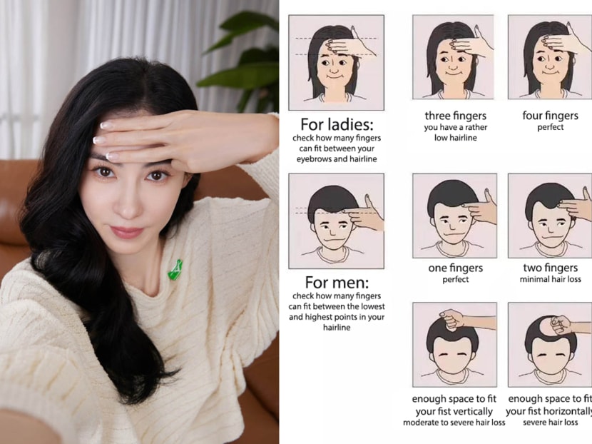 Do you have a perfect hairline according to this chart?
