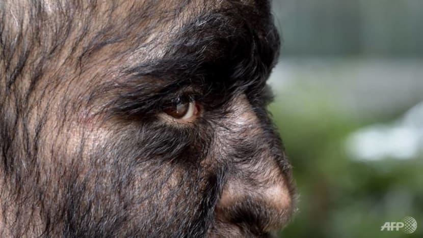 Spanish kids get 'werewolf syndrome' after taking contaminated medicine Spanish kids get 'werewolf syndrome' after taking contaminated medicine