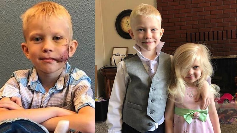 Superheroes praise US 6-year-old who saved sister from dog attack