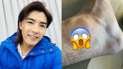 Mike He Shares Photo Of “Super Painful” Ankle Injury Caused By Shoe Spike; Says He “Can’t Stop” The Bleeding