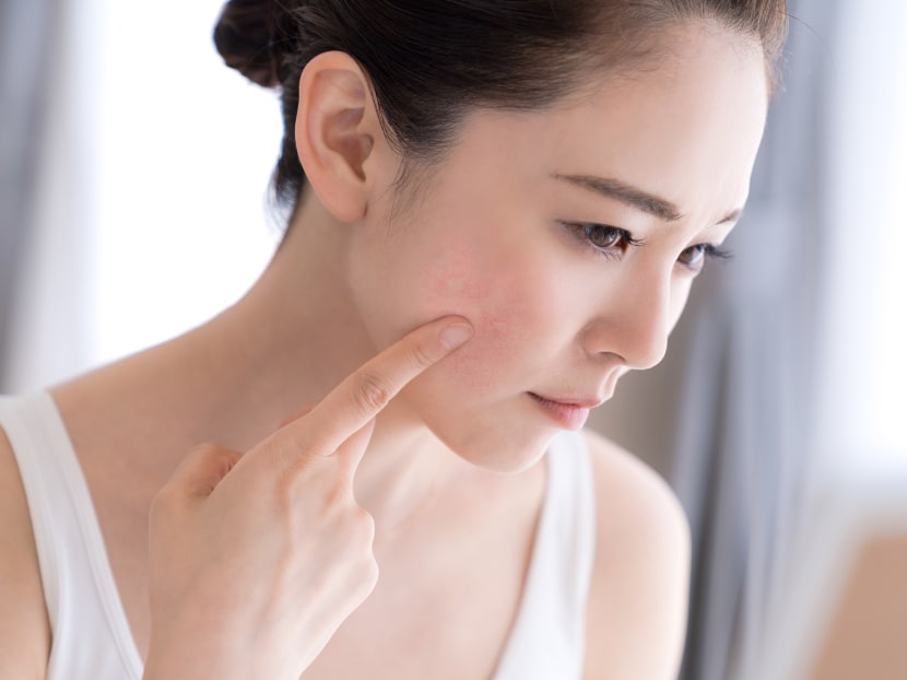 Sensitive skin or eczema: How can you tell and what can you do about it? Sensitive skin or eczema: How can you tell and what can you do about it?