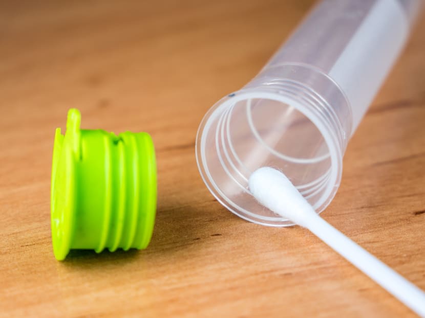 Self-test kits for the human immunodeficiency virus issued under a national programme will take about 20 to 40 minutes to show results after collecting an oral specimen with a swab. Self-test kits for the human immunodeficiency virus issued under a national programme will take about 20 to 40 minutes to show results after collecting an oral specimen with a swab.