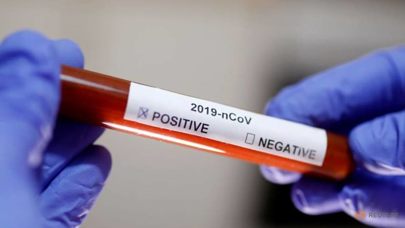 Indonesian health ministry says lab has all needed equipment to detect novel coronavirus