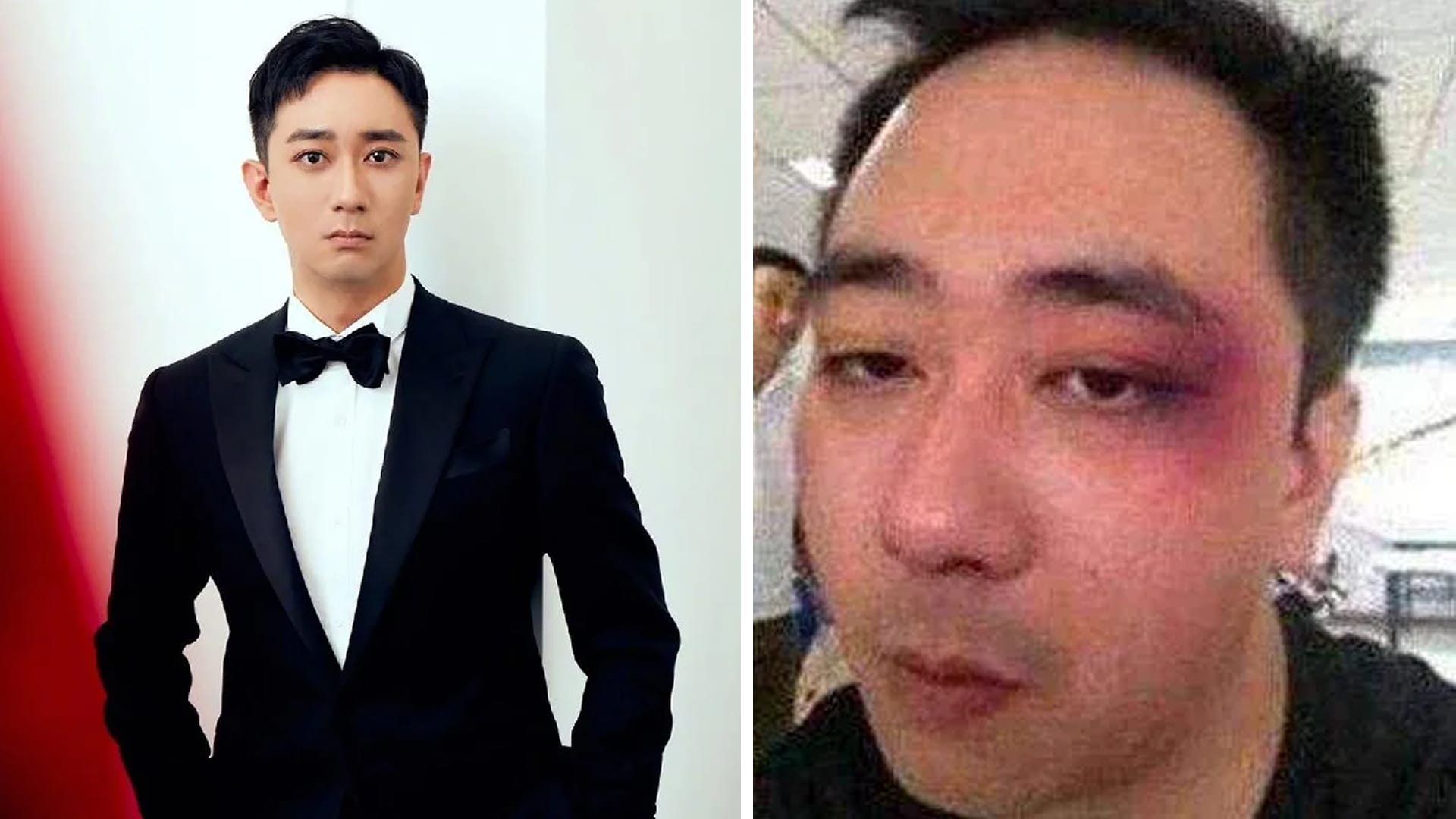 Chinese Actor Wang Zijian Reveals He Was Abused By MMA Champ Ex-Wife; Says He Was Slapped 500 Times Chinese Actor Wang Zijian Reveals He Was Abused By MMA Champ Ex-Wife; Says He Was Slapped 500 Times
