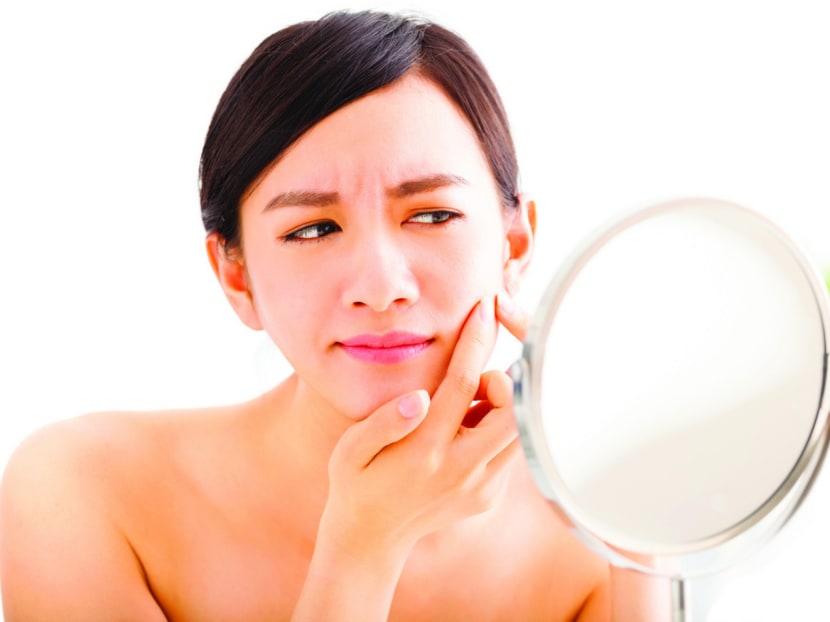 Adult acne on the rise from stress, a lack of sleep and hormonal changes