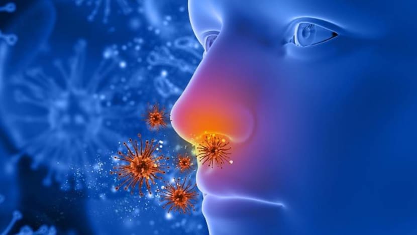 What is Cantonese cancer? 5 facts about nasopharyngeal carcinoma What is Cantonese cancer? 5 facts about nasopharyngeal carcinoma