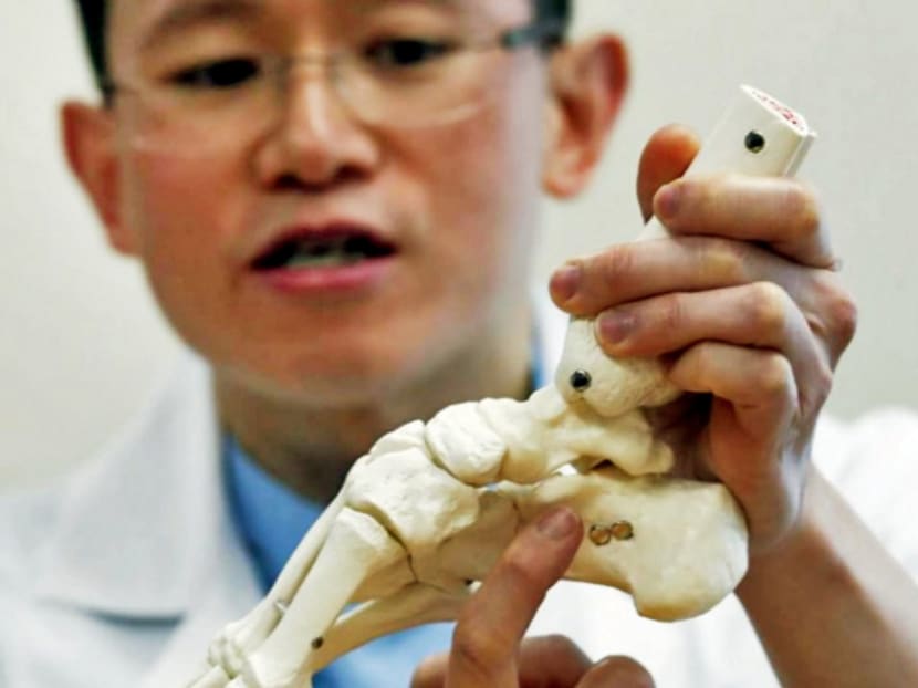Dr Chiu Shin-yeung from Pamela Youde Nethersole Eastern Hospital with a model of the talus one. Doctors at the hospital created a 3D-printed replica of the talus for a patient injured in a traffic accident. Photo: South China Morning Post