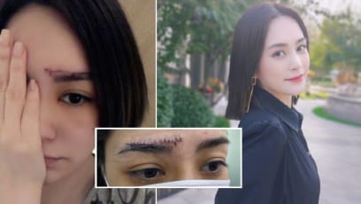 Gillian Chung Shows Off 6cm Scar On Forehead That She Got From Falling In Her Hotel Room