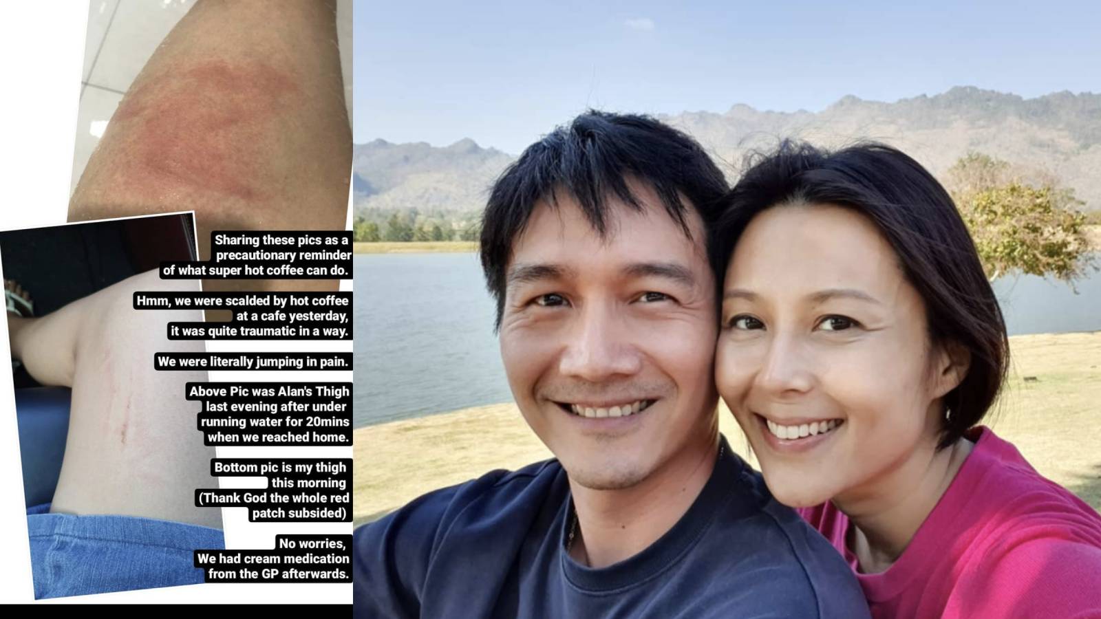 Priscelia Chan And Alan Tern Scalded By Hot Coffee At Cafe; Says It Was Her Husband’s “Blunder” Priscelia Chan And Alan Tern Scalded By Hot Coffee At Cafe; Says It Was Her Husband’s “Blunder”