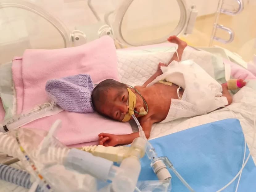 24 week clearance old premature baby