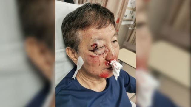 老伯公园连道骑脚踏车遭野猪袭击 公园局：暂封起涉事区域