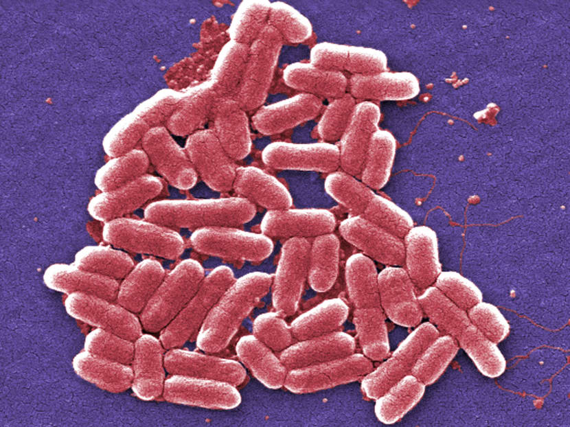 Escherichia coli bacteria. Photo: Janice Haney Carr, Centers for Disease Control and Prevention/AP