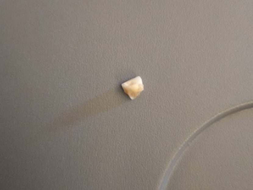 News agency Australian Associated Press first reported that the passenger, Mr Bradley Button, found a tooth that did not belong to him when eating his rice on a Singapore Airlines flight.