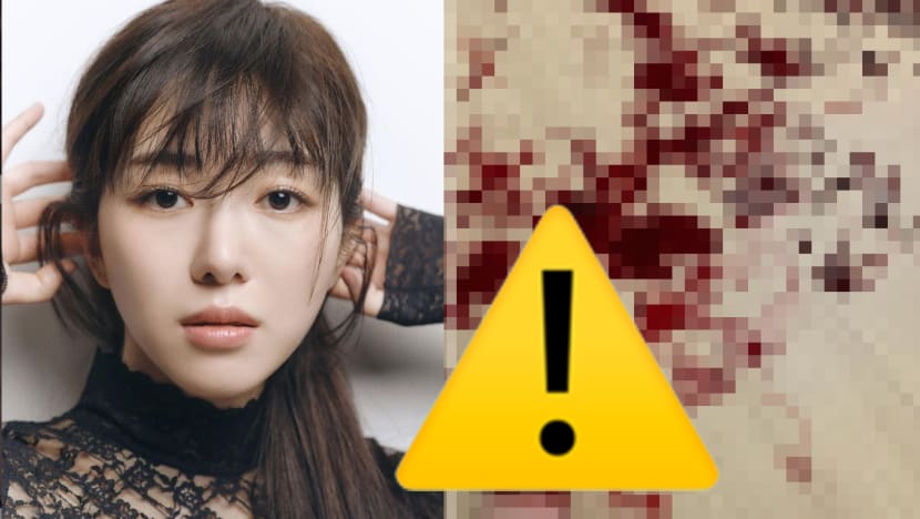Ex Korean Pop Idol Kwon Mina Posts Graphic Pic Of Bleeding Wrist, Says Bullying Is The Cause
