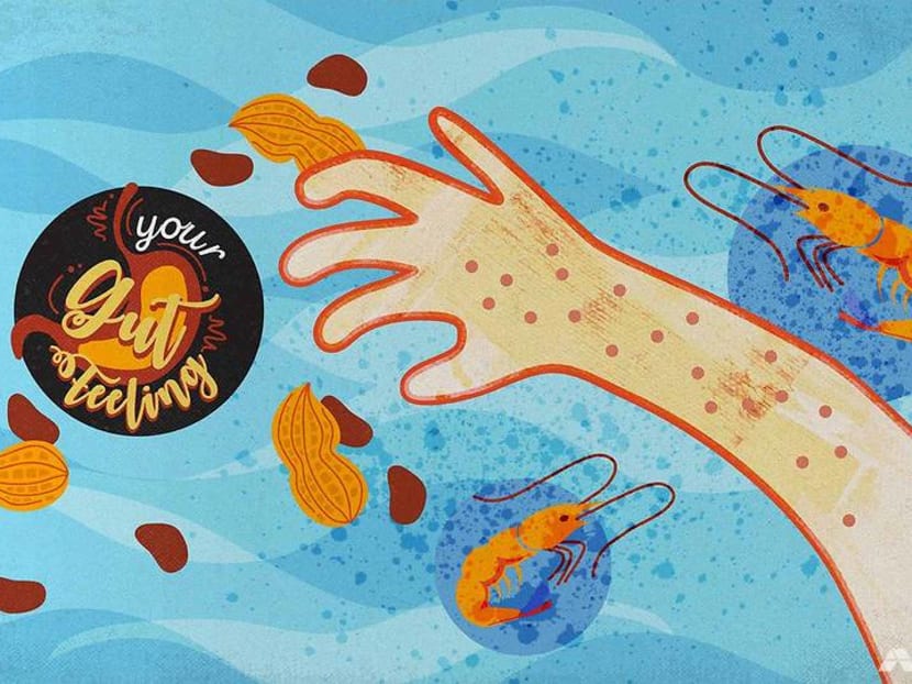Why you might become allergic to shellfish, nuts or even bird’s nest with age Why you might become allergic to shellfish, nuts or even bird’s nest with age