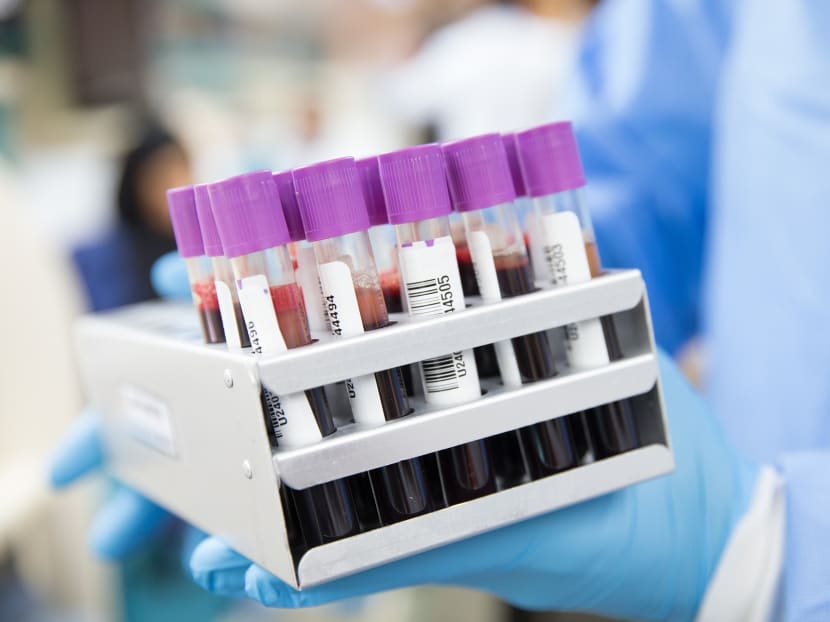 Researchers from the Nanyang Technological University embarked on a study in April 2020 after medical reports of Covid-19 patients experiencing blood clots emerged. Researchers from the Nanyang Technological University embarked on a study in April 2020 after medical reports of Covid-19 patients experiencing blood clots emerged.