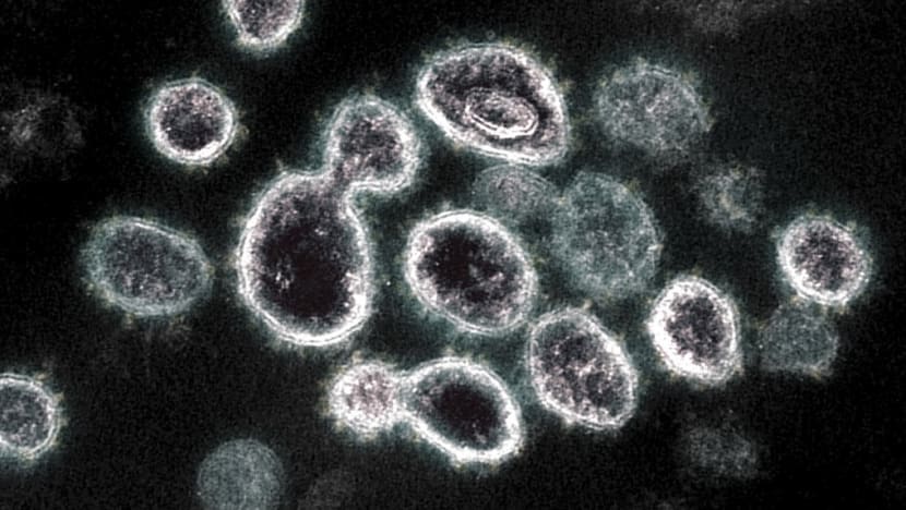 Prior COVID-19 infection more protective than vaccination during Delta surge: US study Prior COVID-19 infection more protective than vaccination during Delta surge: US study